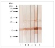 Anti-Calcitonin antibody [16B5] used in Western Blot (WB). GTX11493